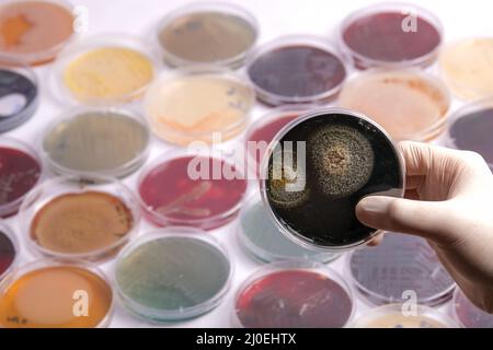 la raccolta di piastre di coltura contiene la crescita di microrganismi su diversi terreni di agar Foto Stock