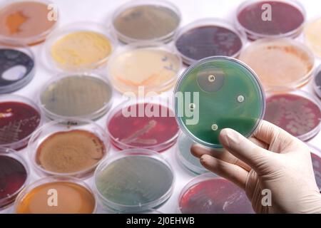 la raccolta di piastre di coltura contiene la crescita di microrganismi su diversi terreni di agar Foto Stock