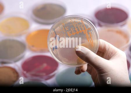 la raccolta di piastre di coltura contiene la crescita di microrganismi su diversi terreni di agar Foto Stock