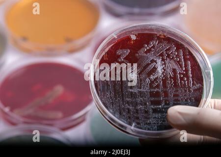 la raccolta di piastre di coltura contiene la crescita di microrganismi su diversi terreni di agar Foto Stock