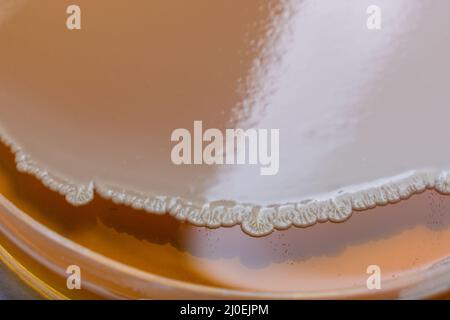 la raccolta di piastre di coltura contiene la crescita di microrganismi su diversi terreni di agar Foto Stock