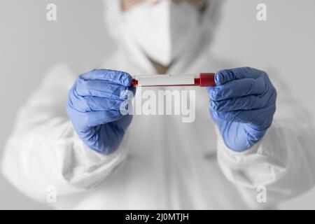 Primo piano medico che tiene un campione di sangue (1) Foto Stock