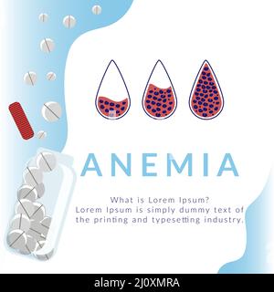 Un concetto sul tema dell'anemia. La differenza di numero di anemia dei globuli rossi e normale. Illustrazione della medicina. Vettore stile piatto Illustrazione Vettoriale