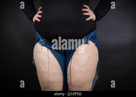 donna grassa in jeans strappati su sfondo nero. Foto di alta qualità Foto Stock