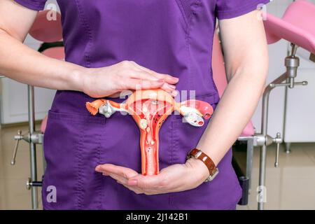 Le mani del medico ginecologo femminile tengono un layout del sistema riproduttivo femminile. Foto Stock