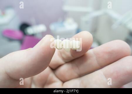 ponti dentali in ceramica metallica nelle mani di un medico Foto Stock