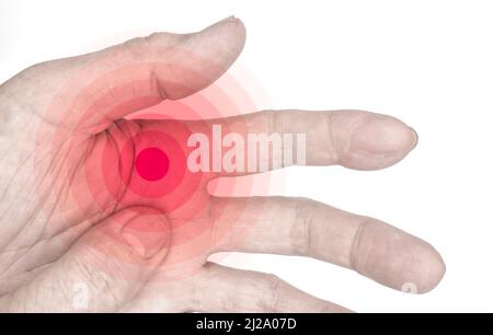 Aspetto palmo doloroso del vecchio asiatico. Concetto di sindrome compartimentale, cellulite e dolore ai muscoli delle mani. Foto Stock