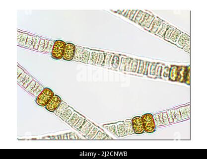 Nodularia sp. Alghe tossiche sotto vista microscopica x100 Foto Stock