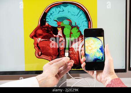 Cervello connesso allo smartphone Foto Stock