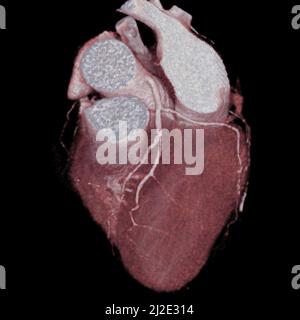 Cuore, scansione Foto Stock