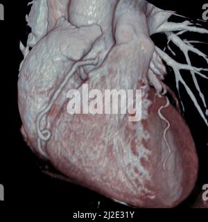 Cuore, scansione Foto Stock