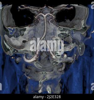 Vertebra cervicale, scansione Foto Stock