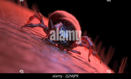 Tick mordere la pelle umana, illustrazione Foto Stock