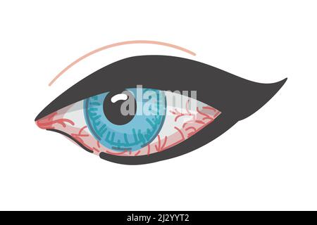Rossore dell'occhio. Malattia del bulbo oculare. Illustrazione vettoriale. Icona isolata. Stile cartoon. Congiuntivite. Illustrazione Vettoriale