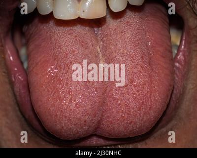 Vista ravvicinata dettagliata che mostra la consistenza di una lingua umana sana circondata da denti ben mantenuti, sottolineando la salute e l'igiene orale Foto Stock