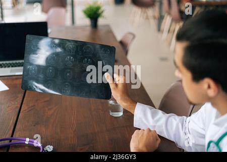 Primo piano POV dei medici di gruppo che discutono insieme storia della malattia del paziente usando la scansione MRI durante la riunione medica. Foto Stock