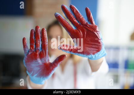Mano sanguinata in guanti medici medico in clinica Foto Stock