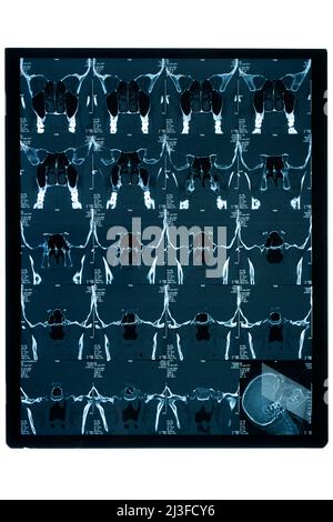 Konica SXG 100: Una Rara Pellicola Scaduta - Foto 10