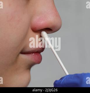 nurse esegue un tampone nasale alla giovane ragazza per cercare il virus del coronavirus durante la pandemia Foto Stock