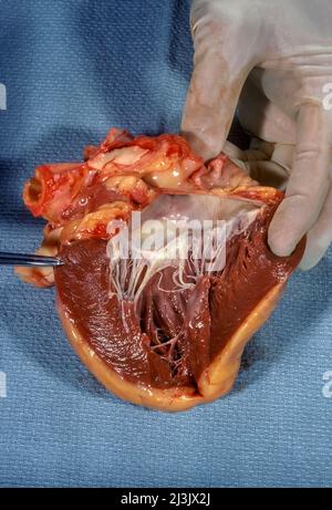 Cuore umano che mostra l'endocardio e il miocardio con valvola mitrale Foto Stock