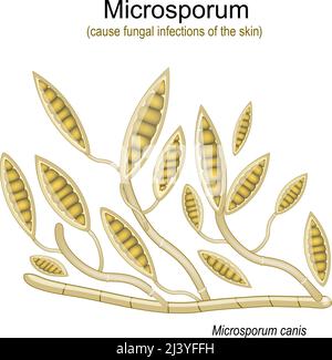 Microsporum, al microscopio. Funghi microscopici che causano infezioni del cuoio capelluto, della pelle del corpo e dei piedi. Illustrazione vettoriale Illustrazione Vettoriale