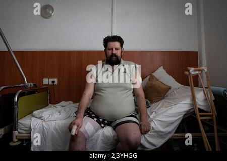 Kiev, Ucraina. 30th Mar 2022. Andrey Bychenko (32), di Gosteml, Kiev Oblast, ferito con fratture ossee multiple e grave perdita di sangue causata da una miniera di terra russa il 25 febbraio è visto in un ospedale a Kiev. Mentre la guerra continua a imperversare, numerosi civili ucraini sono stati feriti e uccisi sotto il fuoco incrociato e l'offensiva russa, e gli ospedali di Kyiv sono ora riforniti di sopravvissuti sottoposti a cure mediche. Secondo le Nazioni Unite, fino al marzo 23, oltre 977 civili sono stati uccisi e 1.594 feriti. Credit: SOPA Images Limited/Alamy Live News Foto Stock