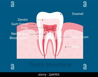 Le fasi di carie dentali, illustrazione vettoriale Illustrazione Vettoriale