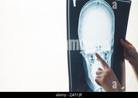 Medico che punta su raggi X di testa studio shot concetto medico . Foto di alta qualità Foto Stock