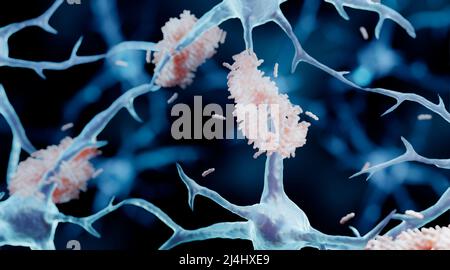 Formazione di placche amiloidi, illustrazione Foto Stock