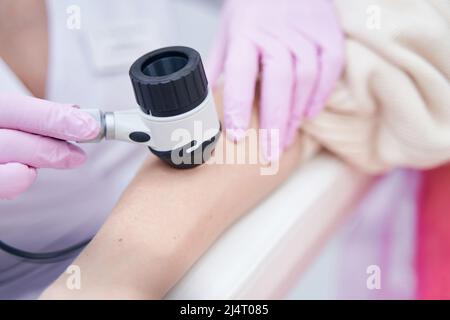 Dermatologo professionista che utilizza il dermoscopio sulla pelle del paziente Foto Stock