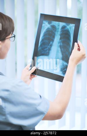 Vista sulla spalla del medico in scrub che indica la presenza di polmonite durante l'analisi dell'immagine radiologica dei polmoni Foto Stock