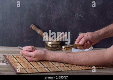 Moxibustion terapia - Medicina tradizionale Cinese. Posizionamento del bastone moxa che brucia sul braccio. Foto Stock