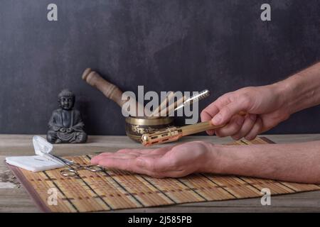 Moxibustion terapia - Medicina tradizionale Cinese. Posizionamento del bastone moxa che brucia sulla mano. Foto Stock