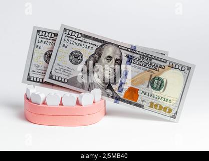 Modello di mandibola in legno con bollette in dollari statunitensi. Spese finanziarie per il trattamento e l'impianto dei denti. Foto di alta qualità Foto Stock