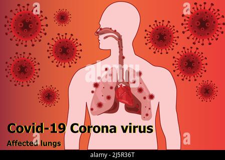 Covid-19 il coronavirus ha influenzato i polmoni Illustrazione Vettoriale