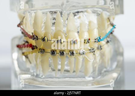 Stampo di denti umani close up. Modello di gesso dentale. Laboratorio protesico di gesso di gesso umano. Dentista cura dei denti imag Foto Stock