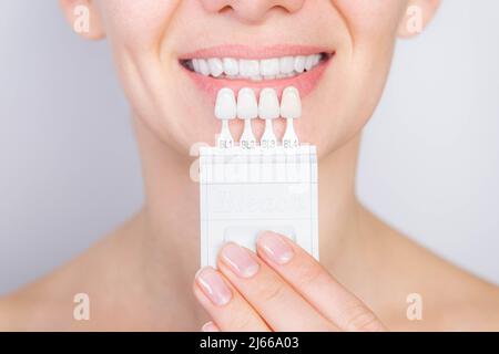 Denti sbiancanti, denti bianchi perfetti in primo piano con ombra guida colore sbiancante, femmina impiallacciatura sorriso, cura dentale e stomatologia, odontoiatria. Foto Stock