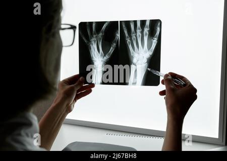 Traumatologo chirurgo che esamina una radiografia del polso traumatizzato. Concetto di assistenza sanitaria e assicurazione medica Foto Stock