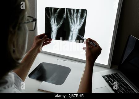 Traumatologo chirurgo che esamina una radiografia del polso traumatizzato. Concetto di assistenza sanitaria e assicurazione medica Foto Stock