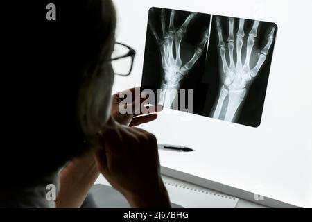 Traumatologo chirurgo che esamina una radiografia del polso traumatizzato. Concetto di assistenza sanitaria e assicurazione medica Foto Stock