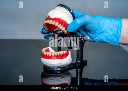 Protesi dentaria nelle mani del medico primo piano. Dentista che tiene ponte dentistico in ceramica. Vista frontale della dentiera completa. Odontoiatria concettuale pho Foto Stock