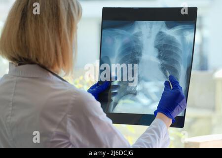 Il medico diagnostica lo stato di salute del paziente con asma, malattie polmonari e COVID-19 Foto Stock