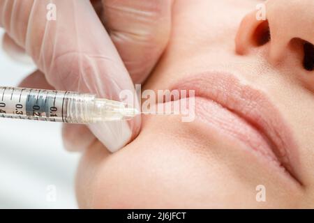 Primo piano delle mani del cosmetologo che fa l'iniezione botox nelle labbra femminili. Correzione della forma del labbro, aumento del labbro. Foto Stock