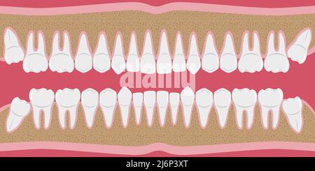 Denti umani bianchi sani di fila. Denti belli, anche con radici. Le gengive vengono tagliate all'osso. Struttura della ganascia. Elementi infografici per den Illustrazione Vettoriale