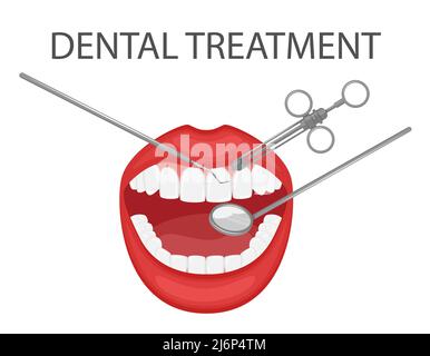 Esame dentale e trattamento dei denti con uno specchio e strumenti. Appuntamento dentale preventivo professionale. Una bocca aperta con denti bianchi. Dentale Illustrazione Vettoriale