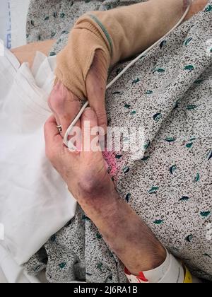 La donna anziana stringe le mani sopra la cammetta dell'ospedale. Foto Stock