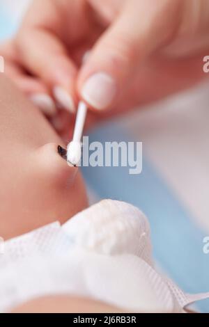 Trattamento dell'ombelico neonato con tampone di cotone Foto stock - Alamy