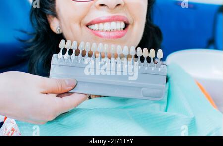 Denti cosmetologici sbiancanti in una clinica dentale, selezione del tono del dente implantare, Woman Holding set di impianti con varie tonalità di Foto Stock