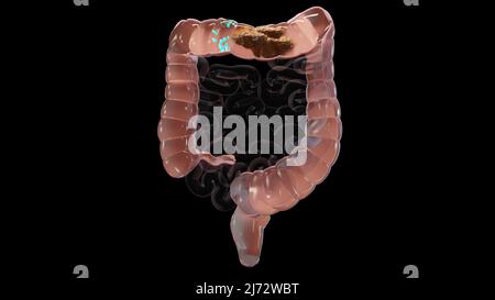 3d illustrazione dell'anatomia umana del sistema digestivo, concetto dell'intestino, lassativo, traitement della costipazione, 3d resa Foto Stock