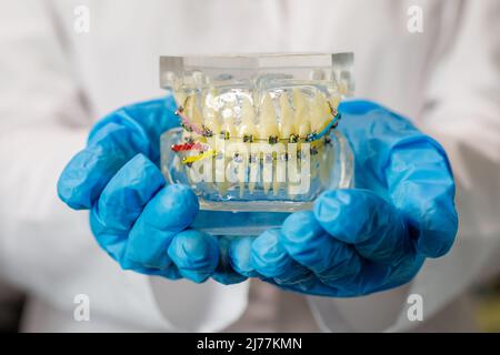 Stampo di denti umani close up. Modello di gesso dentale. Laboratorio protesico di gesso di gesso umano. Dentista cura dei denti imag Foto Stock